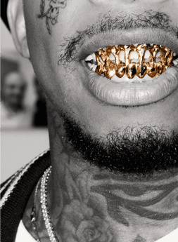 A man showing his Gold Teeth - Gold Teeth USA