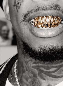 A man showing his Gold Teeth - Gold Teeth USA